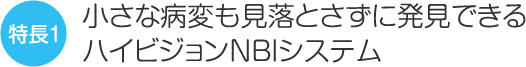 小さな病変も見落とさずに発見できるハイビジョンNBIシステム